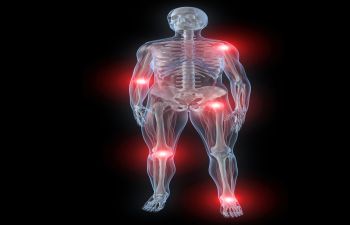 Joint Pain New York NY